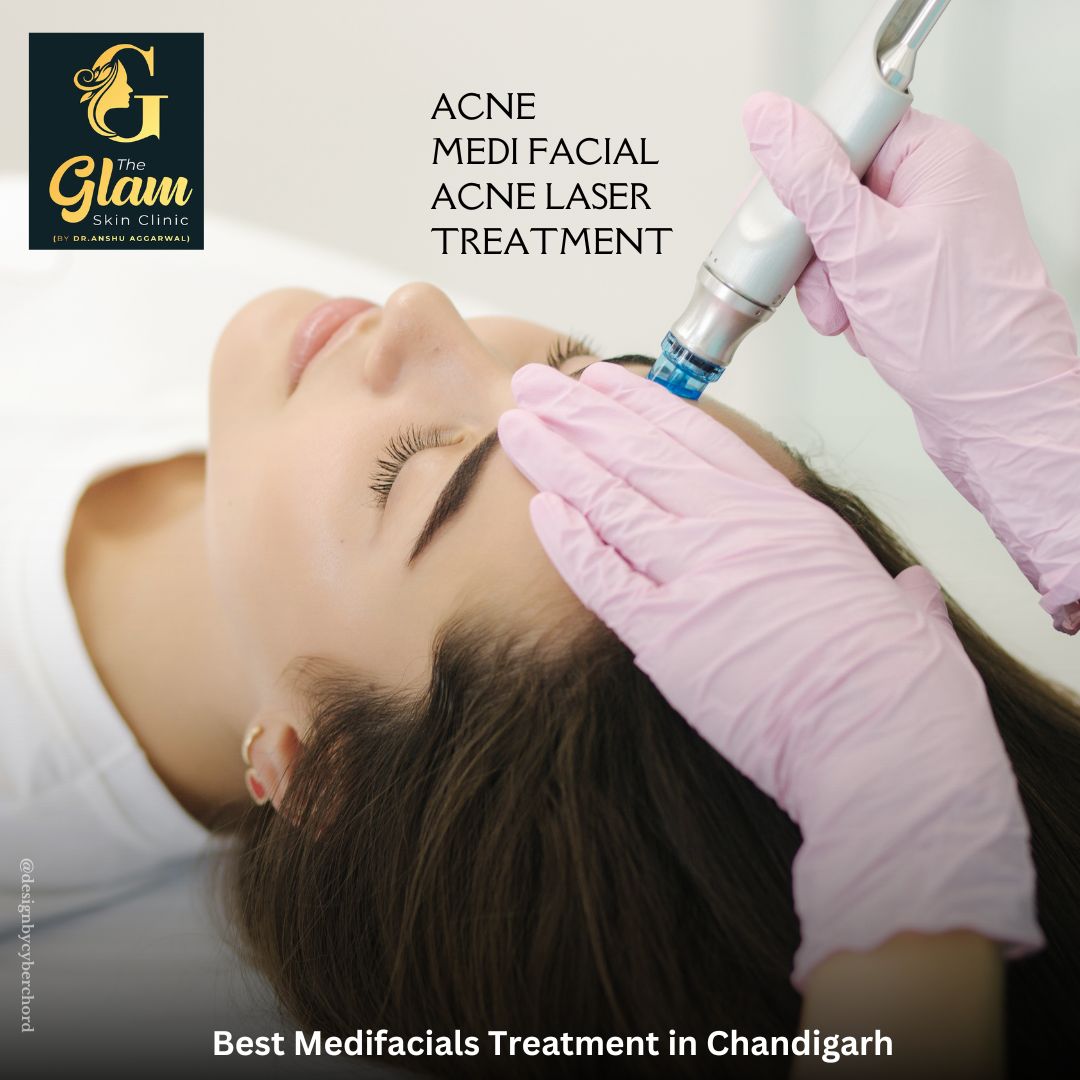 Is Medifacials Available in Chandigarh
