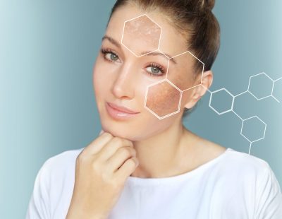 Best Skin Pigmentation Treatment in Chandigarh
