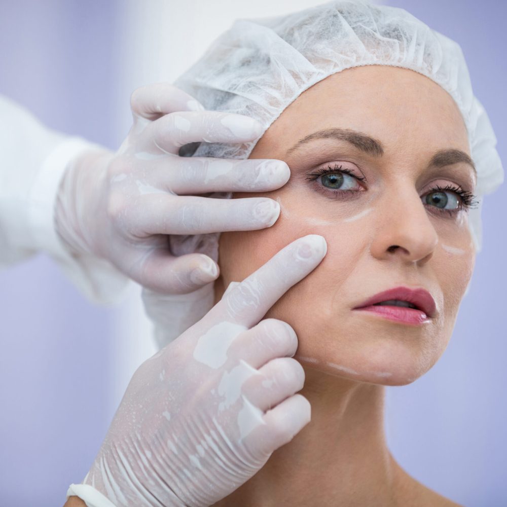 Fillers for under-eye​ Treatment